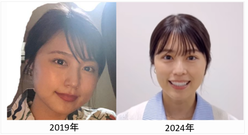 有村架純の2019年と2024年の比較